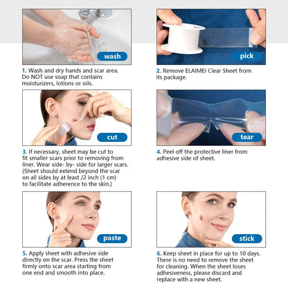 Stap Silicone Cicatrice - Visage & Corps 1.5cm